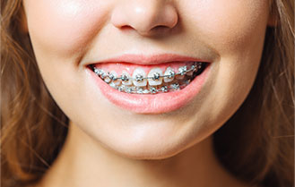 Orthodontics
