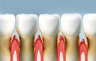 Periodontics